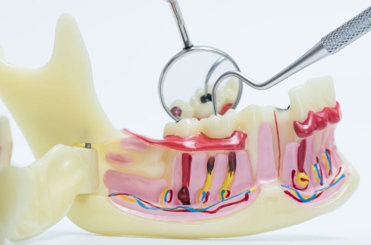 En-Brace Dental