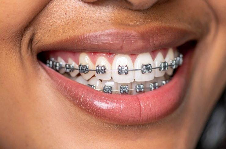 En-Brace Dental