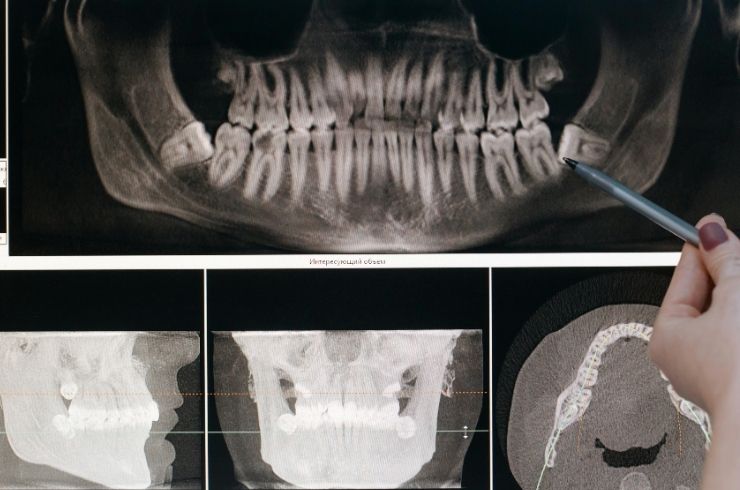 En-Brace Dental